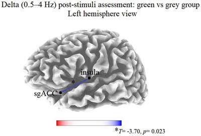 Exposure to nature is associated with decreased functional connectivity within the distress network: A resting state EEG study